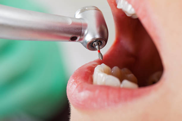 Best Dentist for Tooth Abscess  in Kalispell, MT